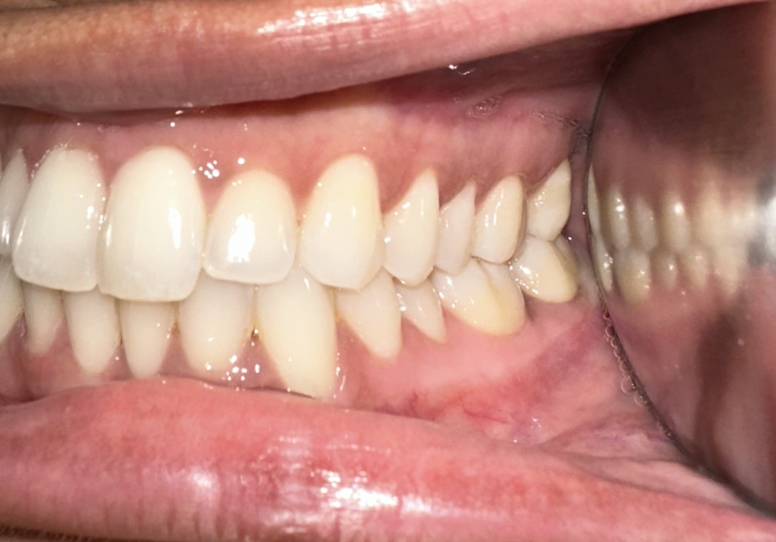 left mouth virtual consult photo