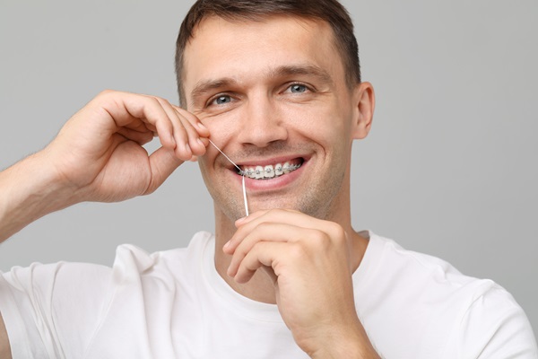 Adult Braces: Key Things To Know