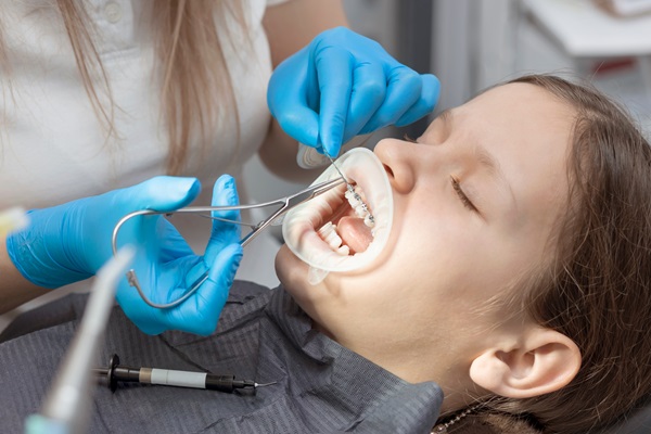 Questions To Ask Your Pediatric Dentist About Children’s Braces